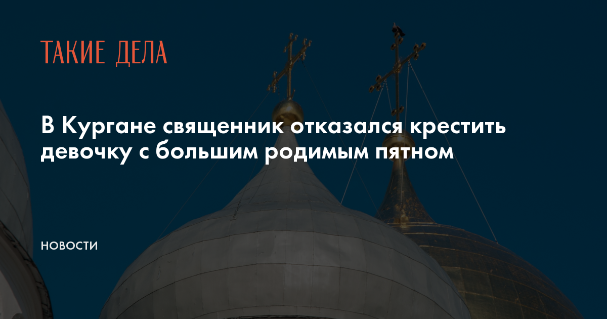 В Кургане священник отказался крестить девочку с большим родимым пятном