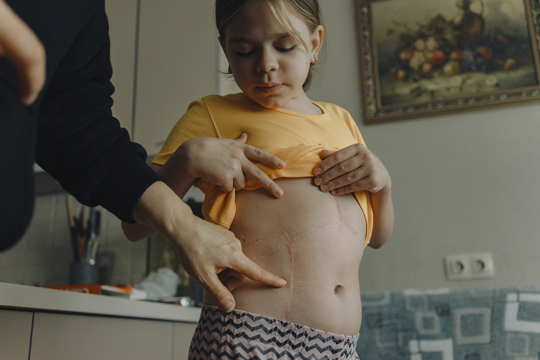 Почки для дочки